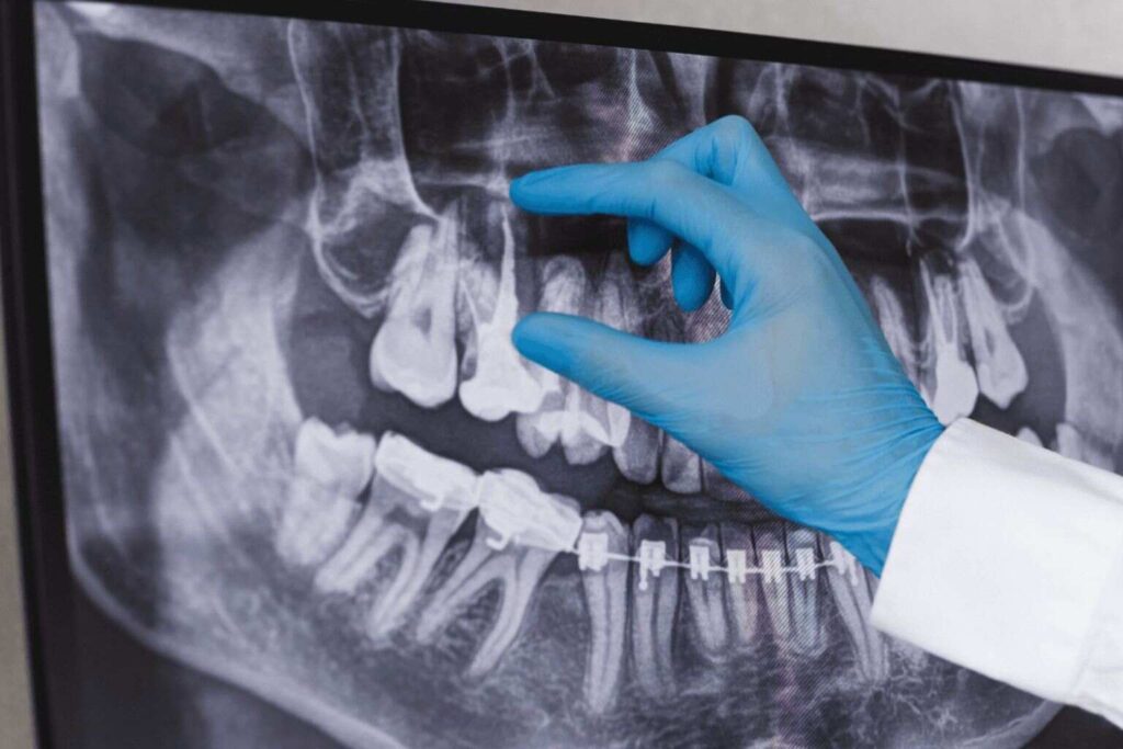 Radiografia Marketing_Endodontista Odonto Social Mídia