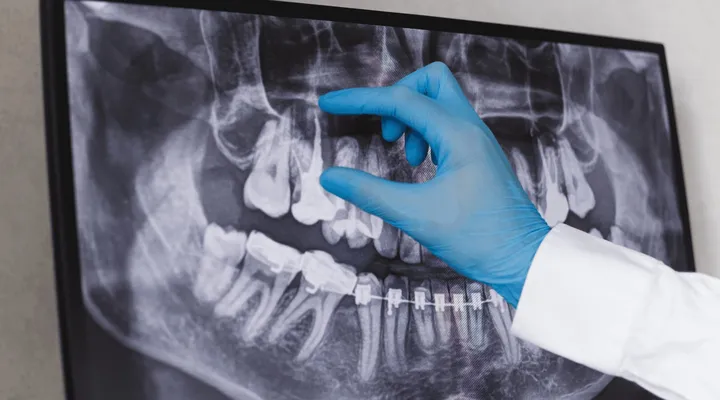 Marketing para Endodontista Odonto Social Mídia